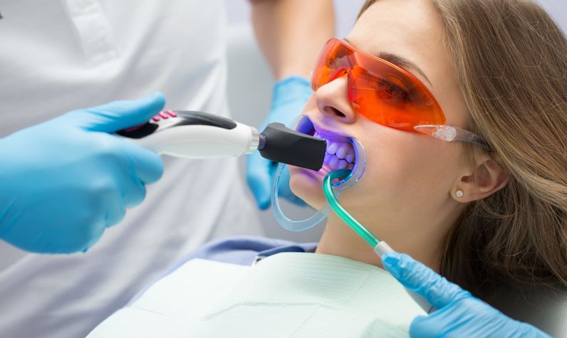 Лазерное отбеливание в стоматологии Брекет Систем