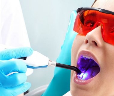 Отбеливание зубов: методики и результаты