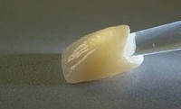 Зубная безметалловые коронки керамика