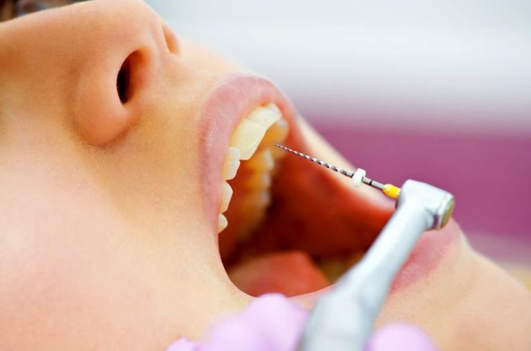 Современные методики лечения зубов