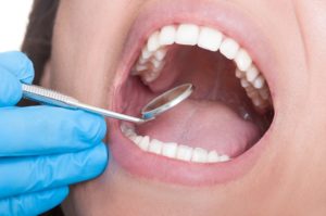 Лечение корней зубов в стоматологии в Нижнем Новгороде