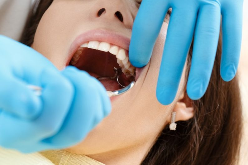 Услуга сложного удаления зубов в стоматологии
